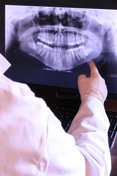 Best Emergency Dental Care for Broken or Chipped Teeth in Todd Creek, CO