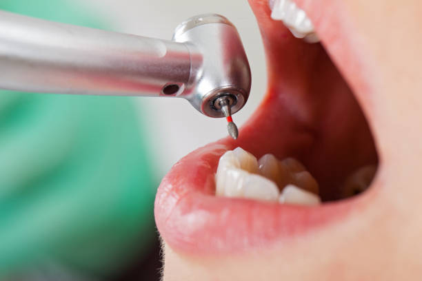 Best Emergency Denture Repair in Todd Creek, CO